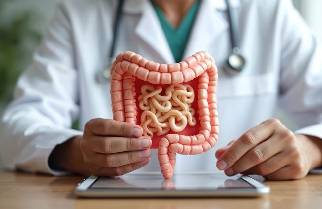 Der Darm ist das größte Organ des Verdauungsapparates – und eines der wichtigsten Organe überhaupt. Ernährungsgewohnheiten und Lebensstil fördern zunehmend chronische Erkrankungen.